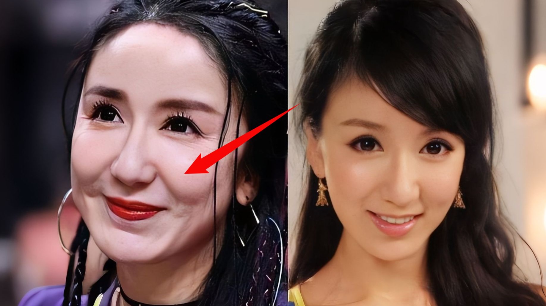 整容,成为理想的自己?...