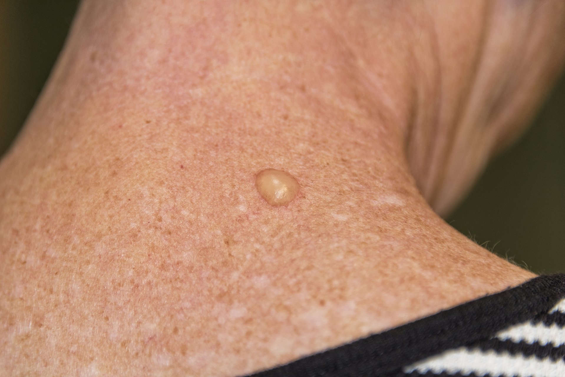 手机屏里的iis是什么意思