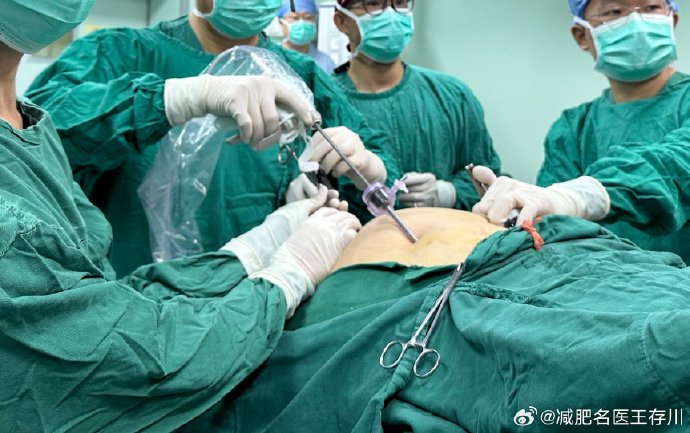 一台等了20年的手术?...