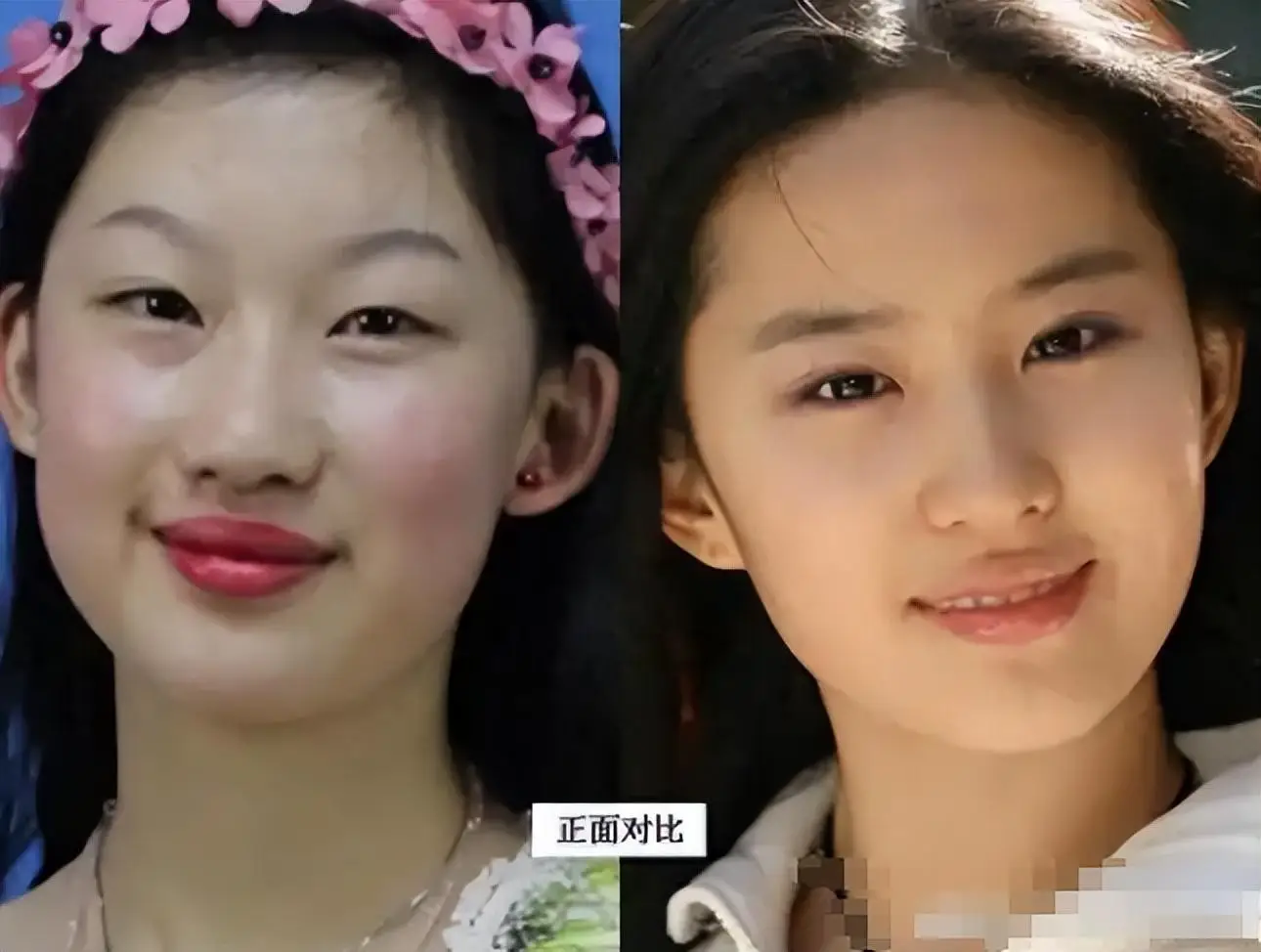 整容能整成理想模样吗 整容如何影响人生轨迹