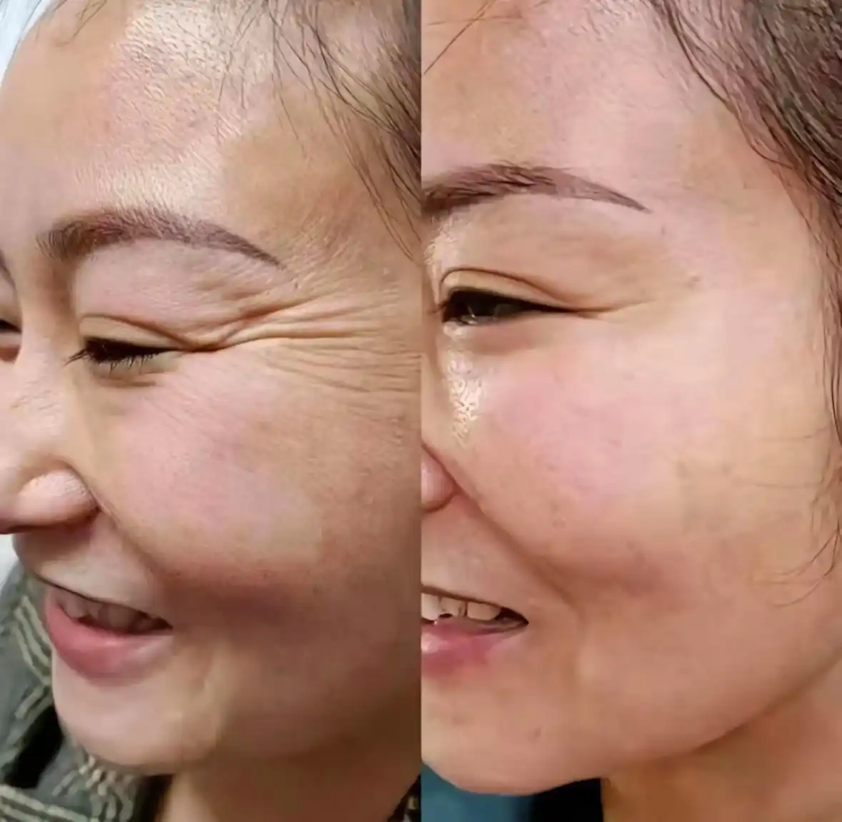 男士护肤品抗皱抗衰老 海马体修图会过分吗 海马体拍照注意事项